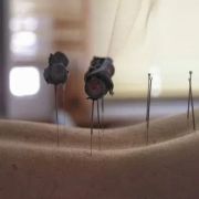 Island Acupuncture &amp; Massage photo