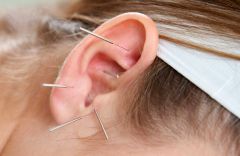 Island Acupuncture &amp; Massage photo